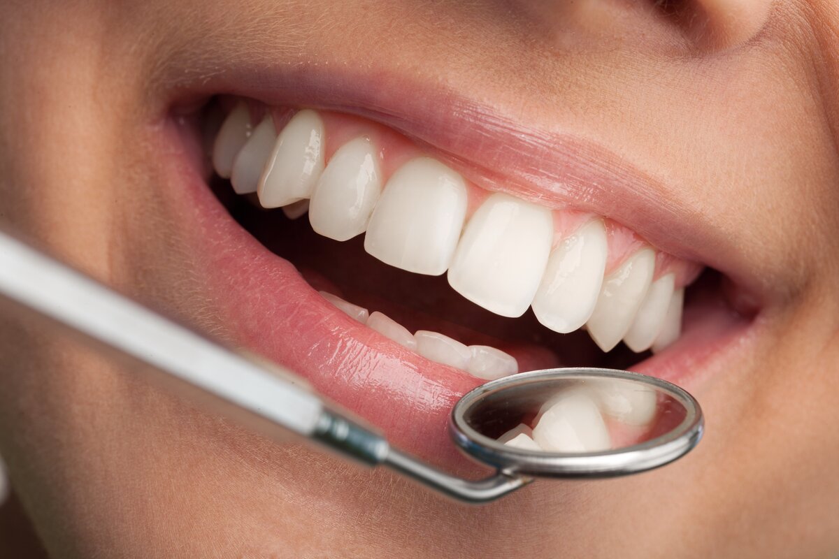 Sorriso perfeito com espelho dental